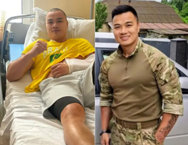 Nguyễn Lâm Tùng, còn gọi là Tùng "bộ đội", khi bị thương năm 2024 và khi gặp tác giả năm 2025