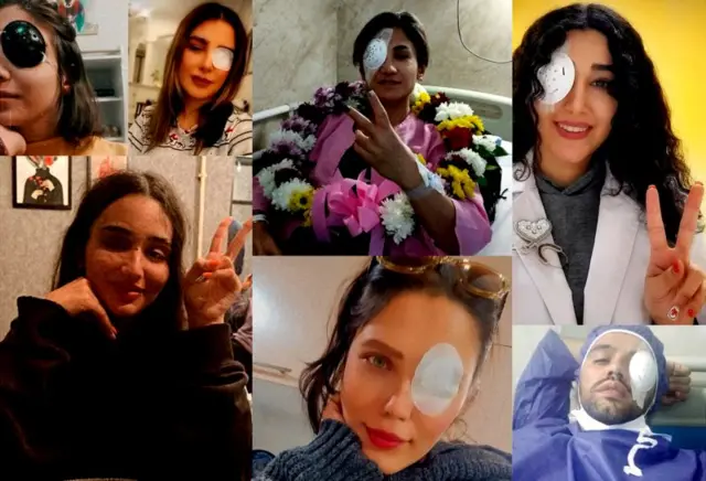 تصاویری از آسیب‌دیدگان چشم