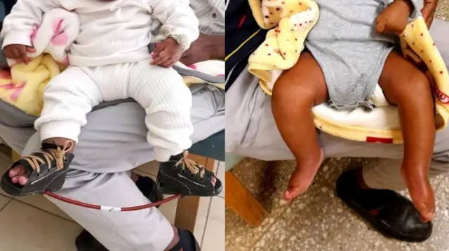 Namoonni daa'imi isaanii gaafa miilli jallatu akka yaadda'an ogeeyyiin ni ibsu