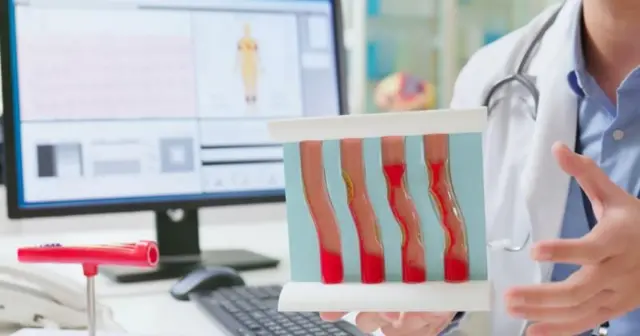 மருத்துவர் ஜெயராஜ் டி பாண்டியன் கருத்துப்படி, எப்போதும் மருத்துவ ஆலோசனையின் படியே மூளை இரத்த ஓட்டத்தை அளவிட வேண்டும் (சித்தரிப்புப் படம்). 