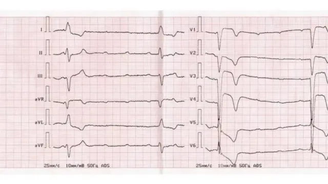 श्रीदेवी