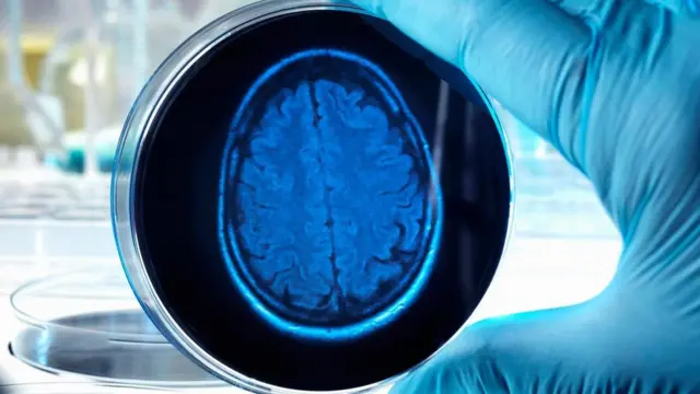 ब्रेने मैंप