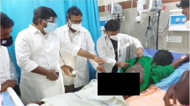 ఉదయ్ ఒంటిపై గాయాలను పరిశీలిస్తున్న విపక్ష నేతలు