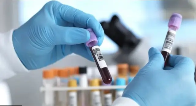 Aworan afihan ayẹwo