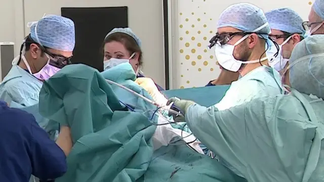 ஒட்டிப் பிறந்த குழந்தைகள்- 4 மாதங்கள் ,55 மணி நேர அறுவை சிகிச்சை - வெற்றியில் முடிந்த போராட்டம்