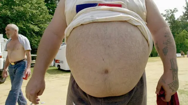 पेट का निकलना