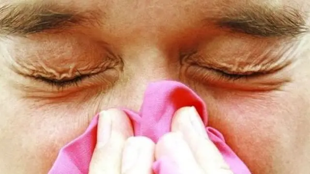 Т. Батыралиев: Баары эле ооруканага жаткысы келет, а ал жактан тескерисинче грипп менен ооруган башкалар менен реинфекция болот да.