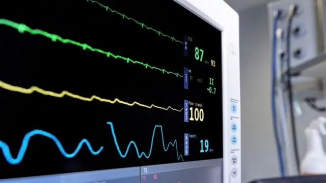 આ ટેકનિકમાં મૃત અંગદાતાના શરીરમાં લોહી પમ્પ કરવામાં આવે છે