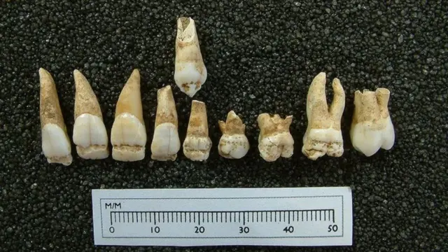 Dentes4rabet vs 1xbetrestos mortais encontrados4rabet vs 1xbetFewston