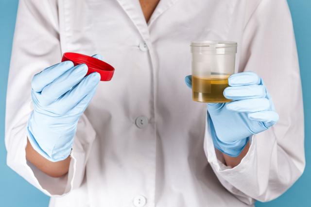 சிறுநீரகம்