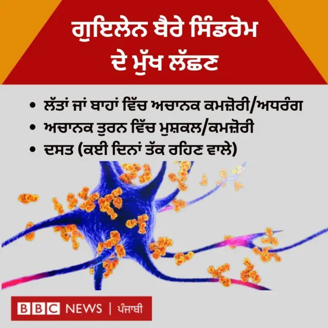 ਗੁਇਲੇਨ ਬੈਰੇ ਸਿੰਡਰੋਮ