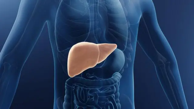 ਚਰਬੀ ਵਾਲਾ ਜਿਗਰ