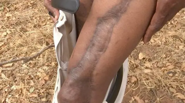 Frank Limbo alijeruhiwa na tembo