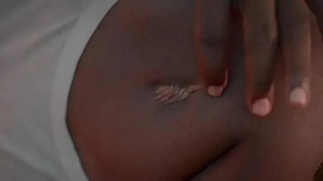 Ahmat anaonyesha jeraha la kutokea begani ambapo risasi ilitoka