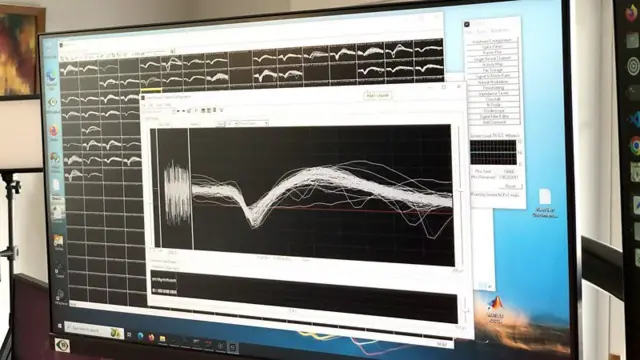Tela de computador mostrando gráfico da atividade cerebral de uma pessoa