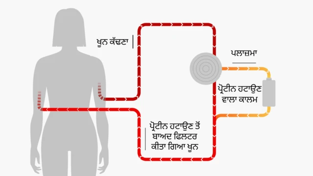 ਖੂਨ ਨੂੰ ਫਿਲਟਰ ਕਰਨਾ