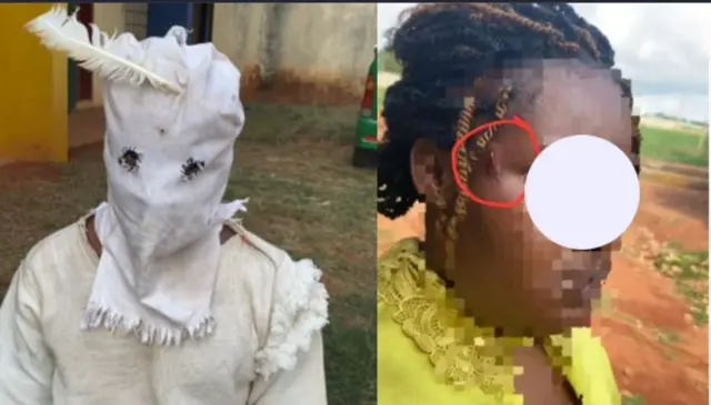 Oriọkpa na nwaanyị o merụrụ ahụ