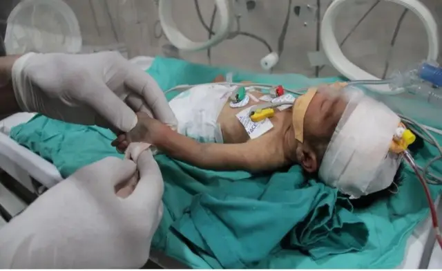 Газа оору бала