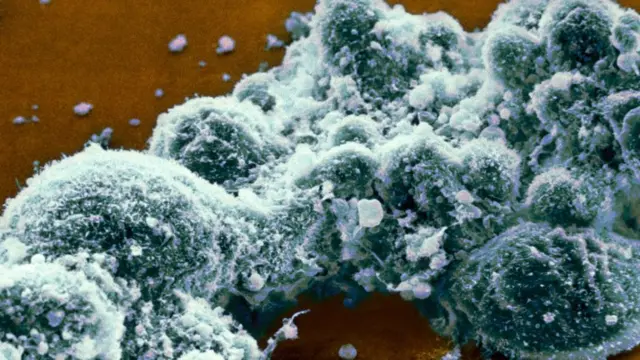 Герпес віруси