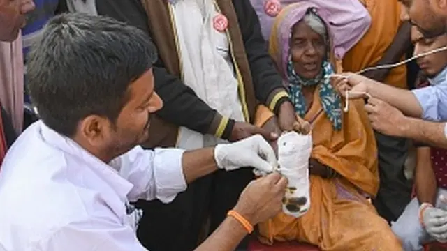 ખેડૂત મહિલાના પગમાં પડેલા છાલાંનો ફોટોગ્રાફ