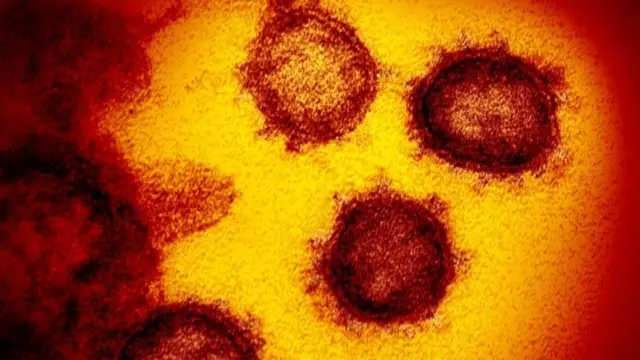 করোনাভাইরাস