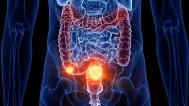 Ilustração do intestino