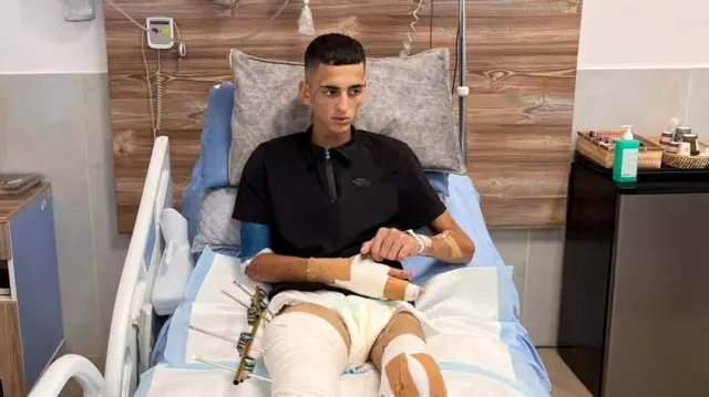 અબ્દુલ રહેમાન 1 સપ્ટેમ્બરથી હૉસ્પિટલમાં છે