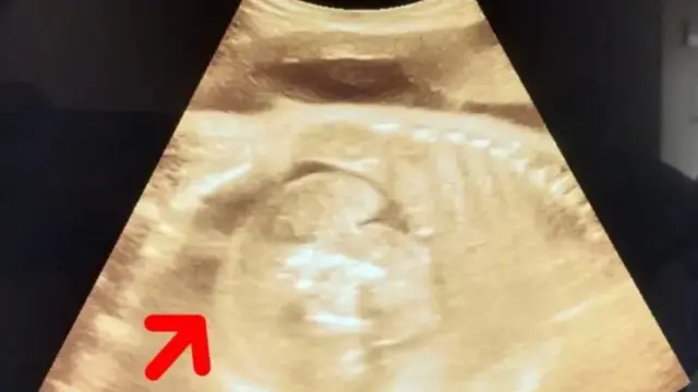 চিকিৎসকেরা জানিয়েছেন এই ঘটনা অত্যন্ত বিরল