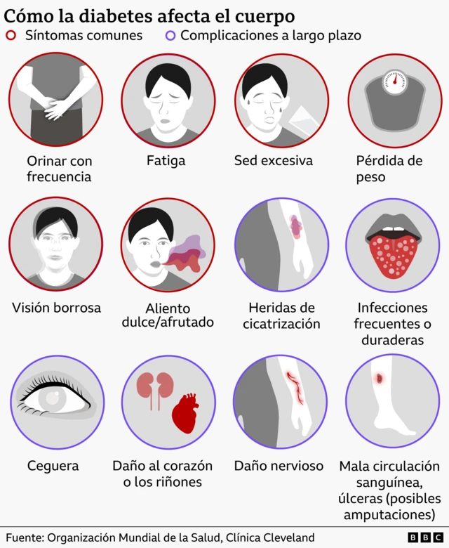 Un gráfico que muestra cómo la diabetes afecta al cuerpo. Los síntomas comunes incluyen la necesidad frecuente de orinar, la fatiga, la sed excesiva, la pérdida de peso, la visión borrosa y el aliento dulce y afrutado. Los síntomas a largo plazo incluyen heridas que cicatrizan lentamente, infecciones frecuentes o duraderas, ceguera, daños en el corazón o los riñones, daños en los nervios y un flujo sanguíneo deficiente. 