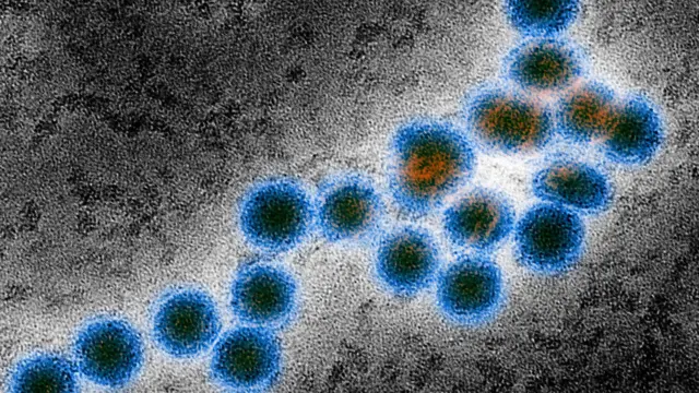 મચ્છર, બીમારી, રોગ, આરોગ્ય, સારવાર, નિદાન, અમેરિકા, ભારત, ન્યૂ યોર્ક 