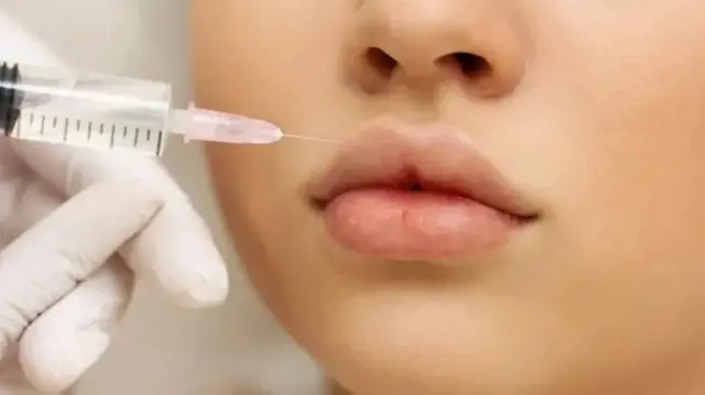 ہونٹوں پر لگائے جانے والے فلرز چھ ماہ سے ایک سال تک قائم رہتے ہیں