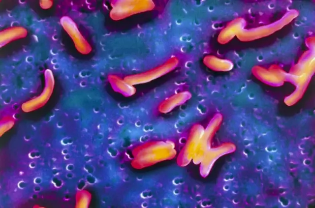 कोलेराको जीवाणु