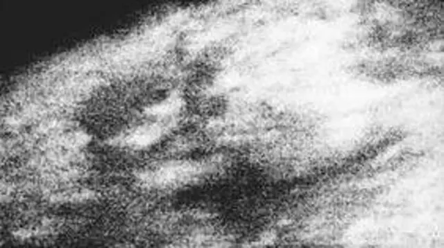 A black-and-white image that is extremely grainy with not much definition; patches of white and black can be seen forming the shape of a sphere close up.