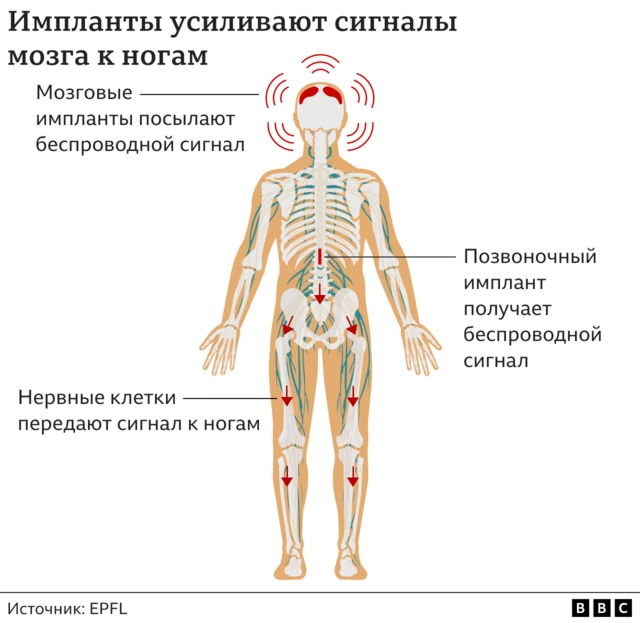 Вынос Моего Мозга