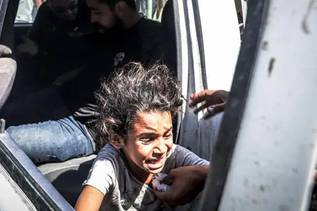 جرحى فلسطينيون