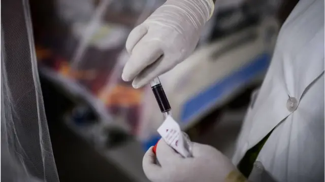 মানবদেহে জিকা শনাক্ত করার ব্যবস্থা বাংলাদেশের হাসপাতাল বা ডায়াগনস্টিক সেন্টারগুলোতে নেই।