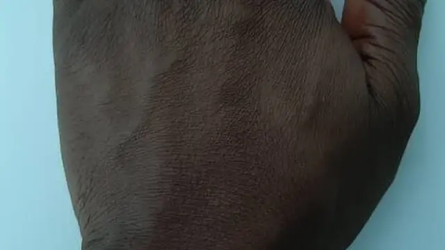 Ahụ kpọrọ nkụ