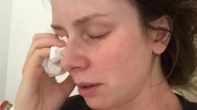 Susie Verrill n'a pas pu quitter sa chambre pendant cinq mois pendant sa grossesse.