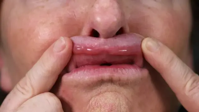 Dibnaha