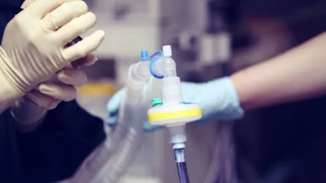 একটি টিউবের সাহায্যে ফুসফুসে অক্সিজেন সরবরাহ করে ভেন্টিলেটর