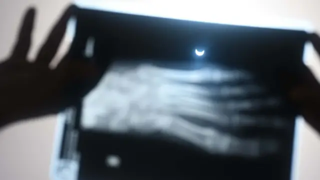 خورشید گرفتگی