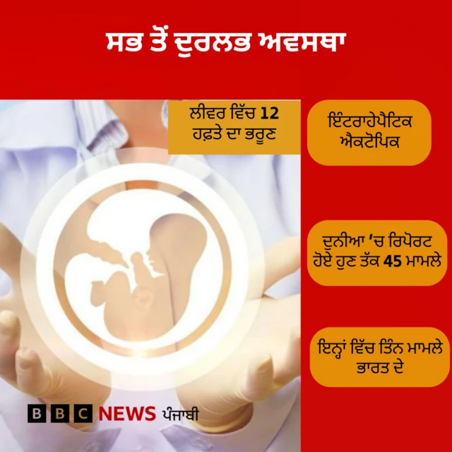 ਦੁਰਲਭ ਅਵਸਥਾ