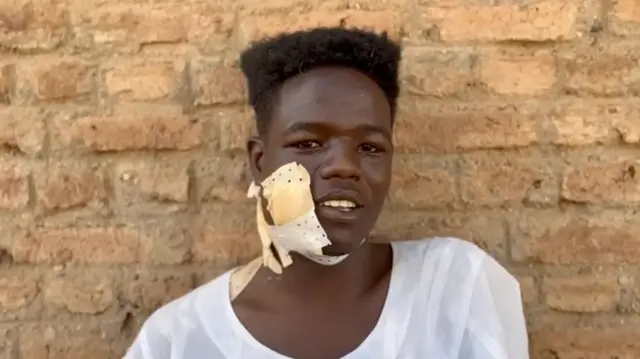 ነብሱ ከድሕን ምስ ተዋጋእቲ ዳዕመ ሰሪዕ ዝተቓለሰ ሱዳናዊ መንእሰይ ኣብ ርእሱን መንከሱን ተወቒዑ