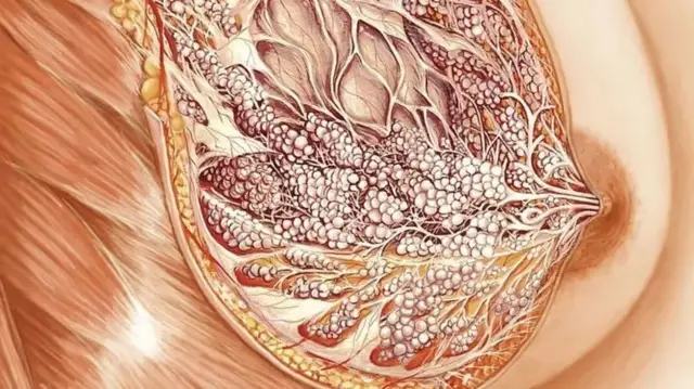 Eserese gosiri ime ara nwaanyị ebe mmiri ara na-akpụkọ