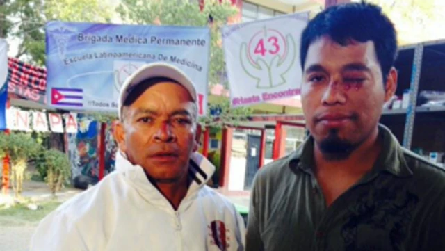 Hombre joven con una herida en el rostros acompañado de un señor mayor. 