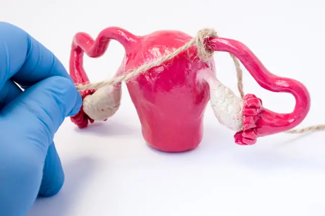 علامتی تصویر 