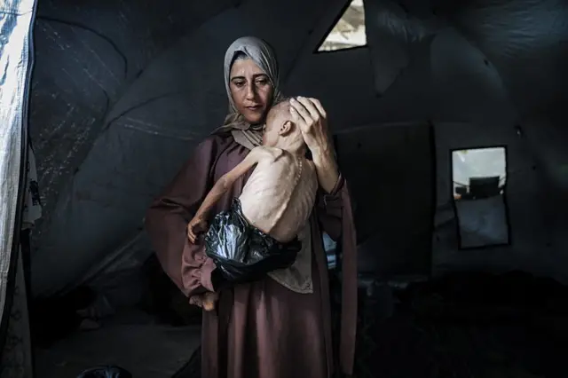 Mulher segura criança muito magra em uma barraca na Faixa de Gaza
