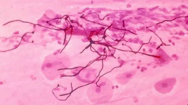 క్యాండిడా ఆరిస్