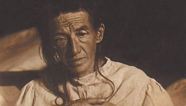 ’الزائیمر‘