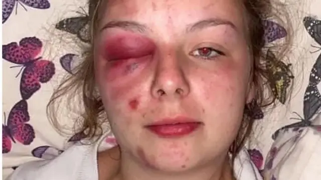 ایلینور ولیمز 